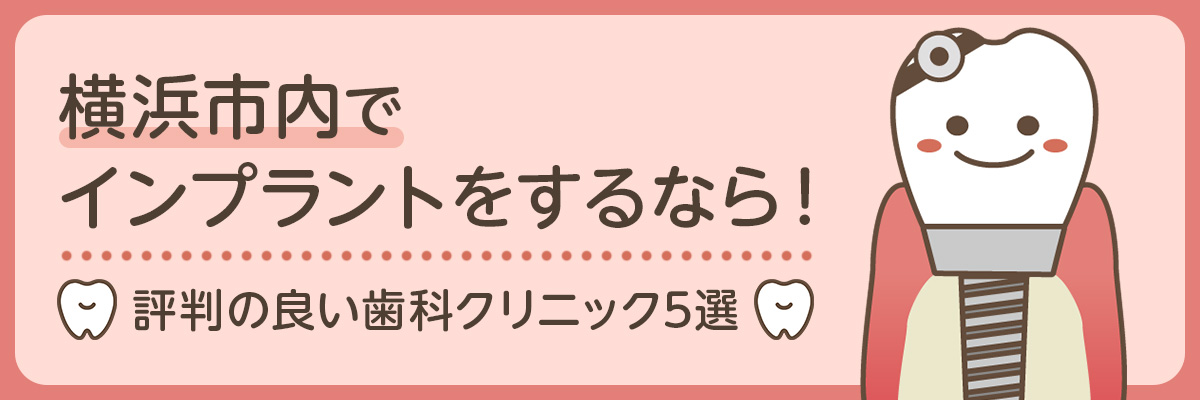 横浜市内でインプラントをするなら！評判の良い歯科クリニック5選